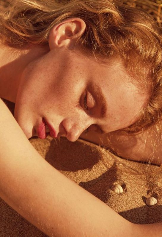 Ini Dia 5 Tip Merawat Kulit Sunburn Buat Kamu Yang Buntu