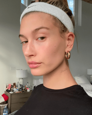 Hailey Bieber Lebih Terbuka Kongsi Masalah Kulit Perioral Dermatitis