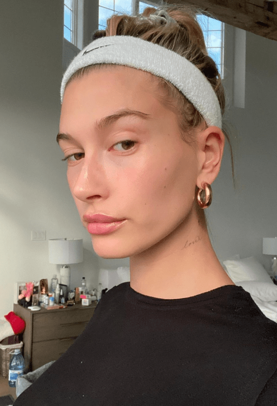 Hailey Bieber Lebih Terbuka Kongsi Masalah Kulit Perioral Dermatitis