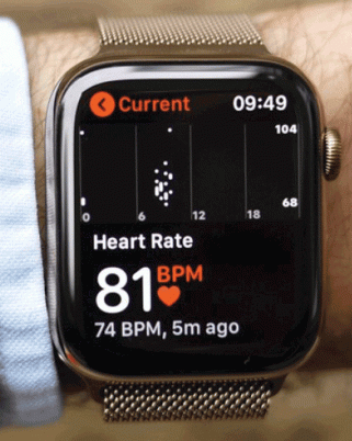 Bagaimana Untuk Elak Ketagih Fitness Tracker? Ini Caranya