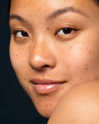 Rahsia Kulit Cerah Berseri: Atasi Dark Spot Dengan Teknologi Terbaru Clinique